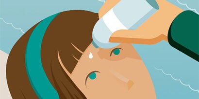 OUT-OF-SIGHT TIPS FOR EYE INJURIES